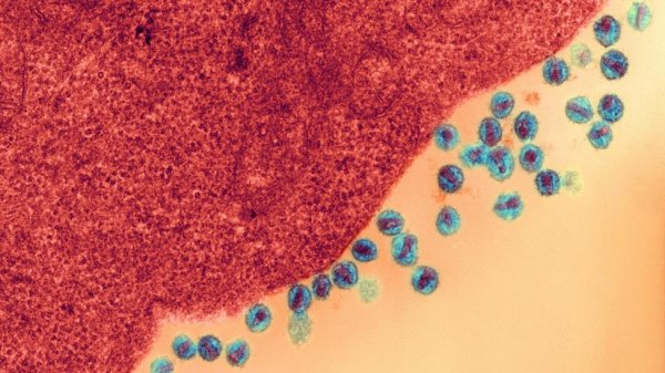 Ученые провели модуляцию цикла жизни ВИЧ