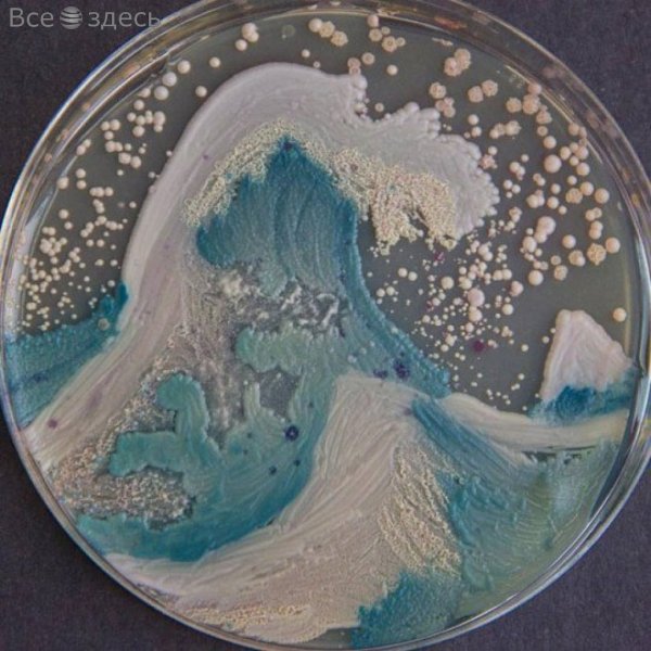 Ученые из США записали симфонию генитальных бактерий