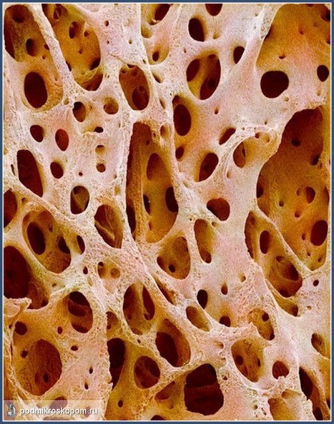 Ученые сумели вырастить искусственную костную ткань