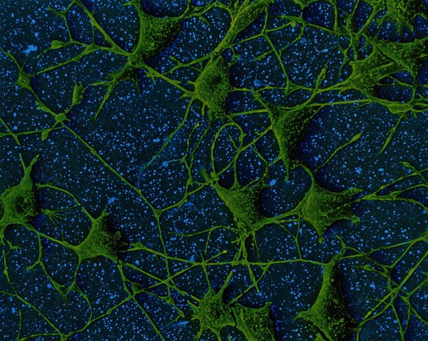 Учёные из России открыли сверхчувствительный белок, который поможет «управлять» нервным клетками