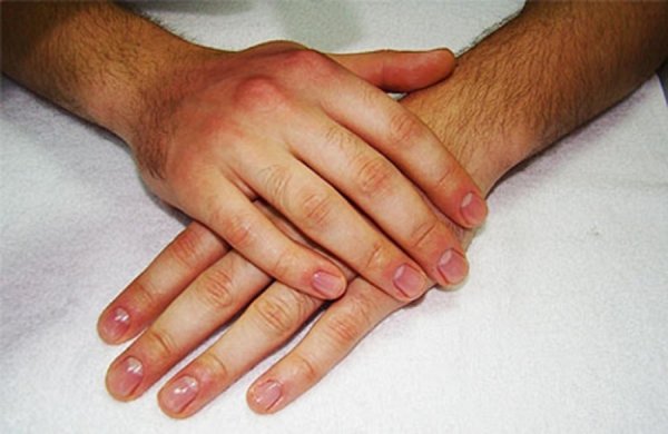 Ученые нашли связь между размером безымянного пальца мужчины и красотой его избранницы