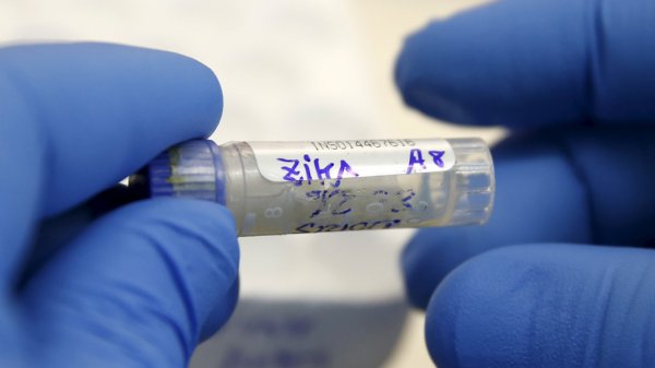 Медики: Вирус Зика все ещё нуждается в исследованиях
